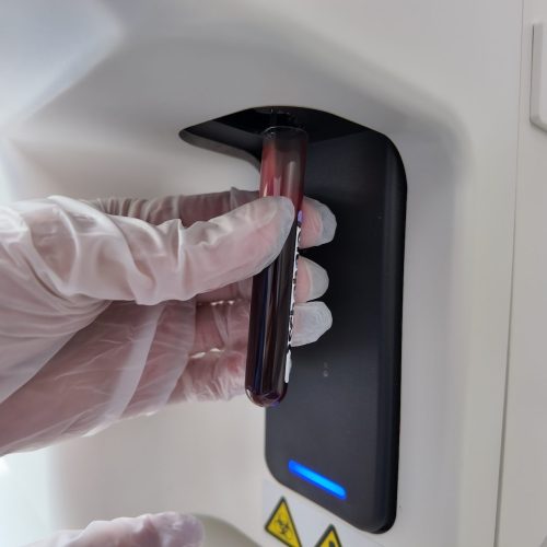 Hematología